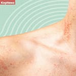 क्या त्वचा की खुजली है Skin Cancer का इशारा? भूलकर भी न करें इन लक्षणों को इग्नोर 1fc232522de285cc8c72c295784423eb